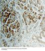 Ribosomal Protein S4, X-Linked (RPS4X) Antibody