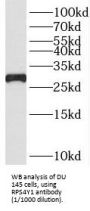 Small Ribosomal Subunit Protein eS4, Y Isoform 1 (RPS4Y1) Antibody