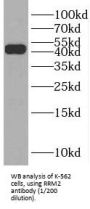 Ribonucleoside-Diphosphate Reductase Subunit M2 (RRM2) Antibody