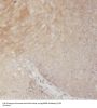 Ribonucleoside-Diphosphate Reductase Subunit M2 (RRM2) Antibody