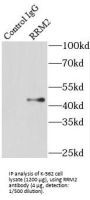 Ribonucleoside-Diphosphate Reductase Subunit M2 (RRM2) Antibody