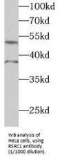 Arginine And Serine Rich Coiled-Coil 1 (RSRC1) Antibody