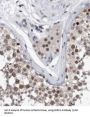 Arginine And Serine Rich Coiled-Coil 1 (RSRC1) Antibody