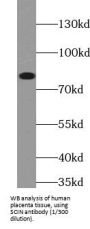 Scinderin (SCIN) Antibody