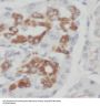 Scinderin (SCIN) Antibody
