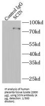 Scinderin (SCIN) Antibody
