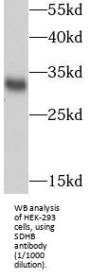 Succinate Dehydrogenase Complex Subunit B (SDHB) Antibody