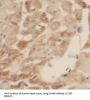 Succinate Dehydrogenase Complex Subunit B (SDHB) Antibody