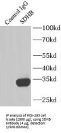 Succinate Dehydrogenase Complex Subunit B (SDHB) Antibody
