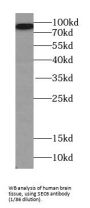 Exocyst Complex Component 3 (EXOC3) Antibody