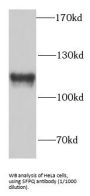 Splicing Factor Proline And Glutamine Rich (SFPQ) Antibody