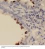 Pulmonary Surfactant-Associated Protein C (SFTPC) Antibody