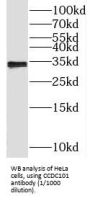SAGA Complex Associated Factor 29 (SGF29) Antibody