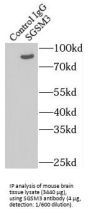 Small G Protein Signaling Modulator 3 (SGSM3) Antibody