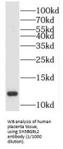 SH3 Domain Binding Glutamate Rich Protein Like 2 (SH3BGRL2) Antibody