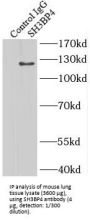 SH3 Domain Binding Protein 4 (SH3BP4) Antibody