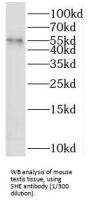 Src Homology 2 Domain Containing E (SHE) Antibody