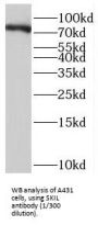 SKI Like Oncogene (SKIL) Antibody