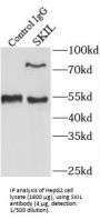 SKI Like Oncogene (SKIL) Antibody