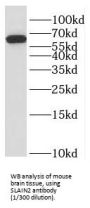 SLAIN Motif Family Member 2 (SLAIN2) Antibody