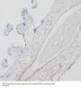 Solute Carrier Family 18,Member 1 (SLC18A1) Antibody