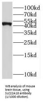 Solute Carrier Family 22 Member 18 (SLC22A18) Antibody