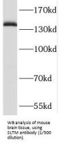 SAFB Like Transcription Modulator (SLTM) Antibody