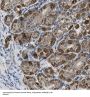 Stromal Membrane-Associated Protein 1 (SMAP1) Antibody