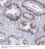SWI/SNF Related, Matrix Associated, Actin Dependent Regulator of Chromatin, Subfamily D, Member 2 (SMARCD2) Antibody