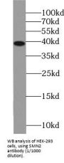 Survival Motor Neuron Protein (SMN) Antibody