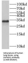 Survival of Motor Neuron-Related-Splicing Factor 30 (SMNDC1) Antibody