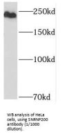 Small Nuclear Ribonucleoprotein U5 Subunit 200 (SNRNP200) Antibody