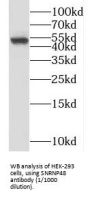 Small Nuclear Ribonucleoprotein U11/U12 Subunit 48 (SNRNP48) Antibody