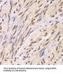 U1 Small Nuclear Ribonucleoprotein A (SNRPA) Antibody