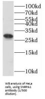 Small Nuclear Ribonucleoprotein Polypeptide A' (SNRPA1) Antibody