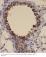 Small Nuclear Ribonucleoprotein Polypeptide A' (SNRPA1) Antibody