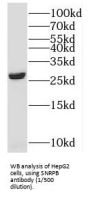 Small Nuclear Ribonucleoprotein Polypeptides B And B1 (SNRPB) Antibody