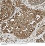 Small Nuclear Ribonucleoprotein Polypeptides B And B1 (SNRPB) Antibody