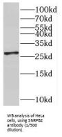 Small Nuclear Ribonucleoprotein Polypeptide B2 (SNRPB2) Antibody