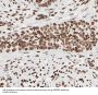 Small Nuclear Ribonucleoprotein Polypeptide B2 (SNRPB2) Antibody