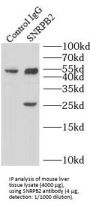 Small Nuclear Ribonucleoprotein Polypeptide B2 (SNRPB2) Antibody