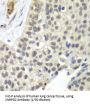 Small Nuclear Ribonucleoprotein D2 Polypeptide (SNRPD2) Antibody