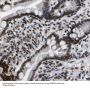 Small Nuclear Ribonucleoprotein D3 Polypeptide (SNRPD3) Antibody