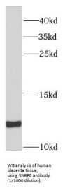 Small Nuclear Ribonucleoprotein E (SNRPE) Antibody