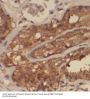 Small Nuclear Ribonucleoprotein Polypeptide F (SNRPF) Antibody