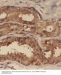 Small Nuclear Ribonucleoprotein Polypeptide G (SNRPG) Antibody