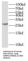 Small Nuclear Ribonucleoprotein-Associated Protein N (SNRPN) Antibody