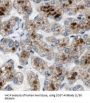 Sclerostin (SOST) Antibody