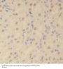 Sex Determining Region Y Box Protein 13 (SOX13) Antibody