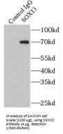 Sex Determining Region Y Box Protein 13 (SOX13) Antibody